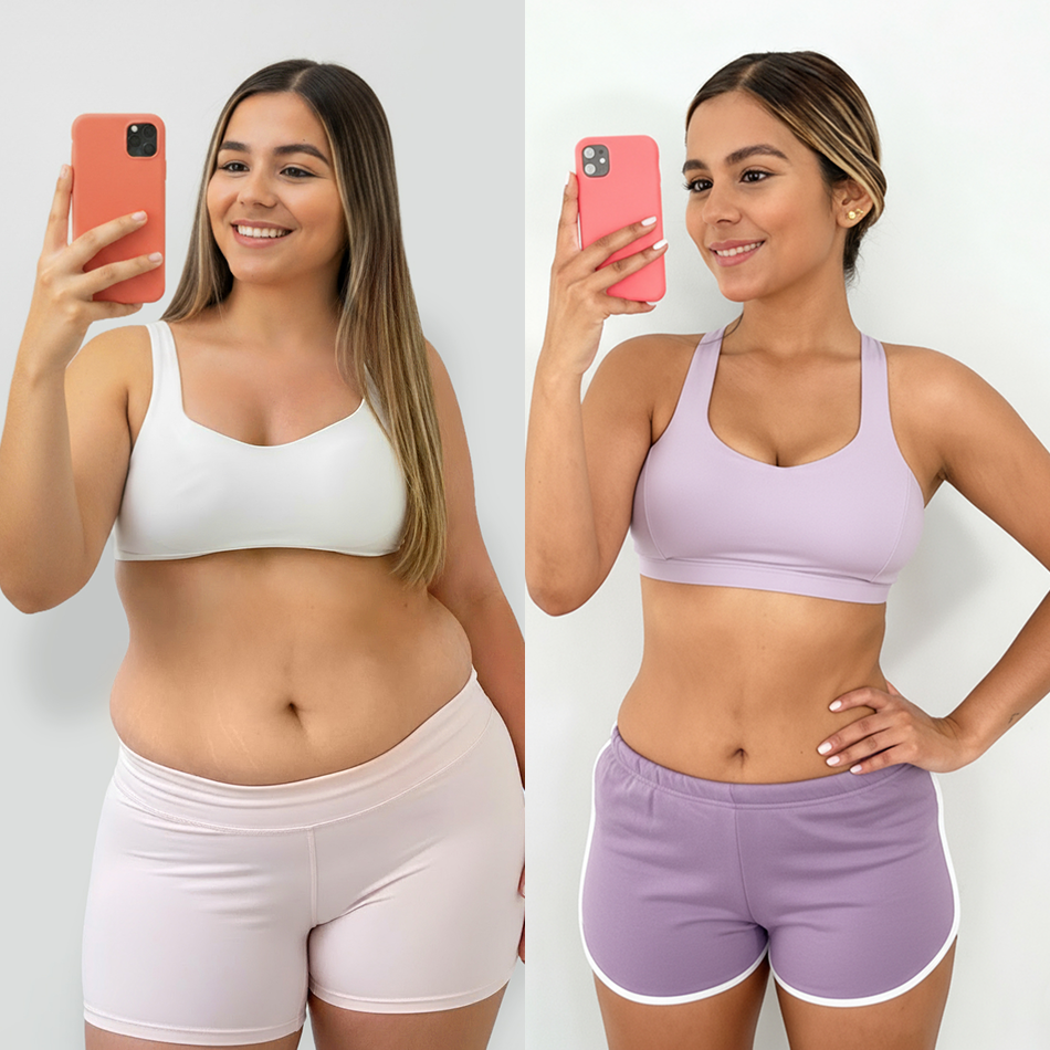 Antes y despues