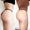 Comparativa de glúteos antes y después del uso de Vibro Sculpt mostrando firmeza y tonificación