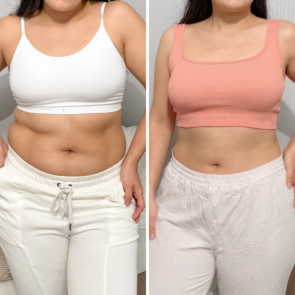 Comparación de abdomen femenino antes y después con Vibro Sculpt para tonificacion