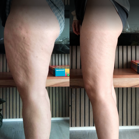 Before and after image